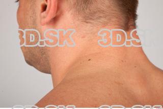 Neck texture of Gene 0003